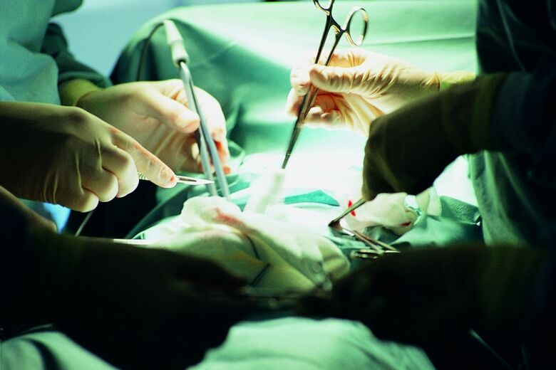 手术增加阴茎厚度